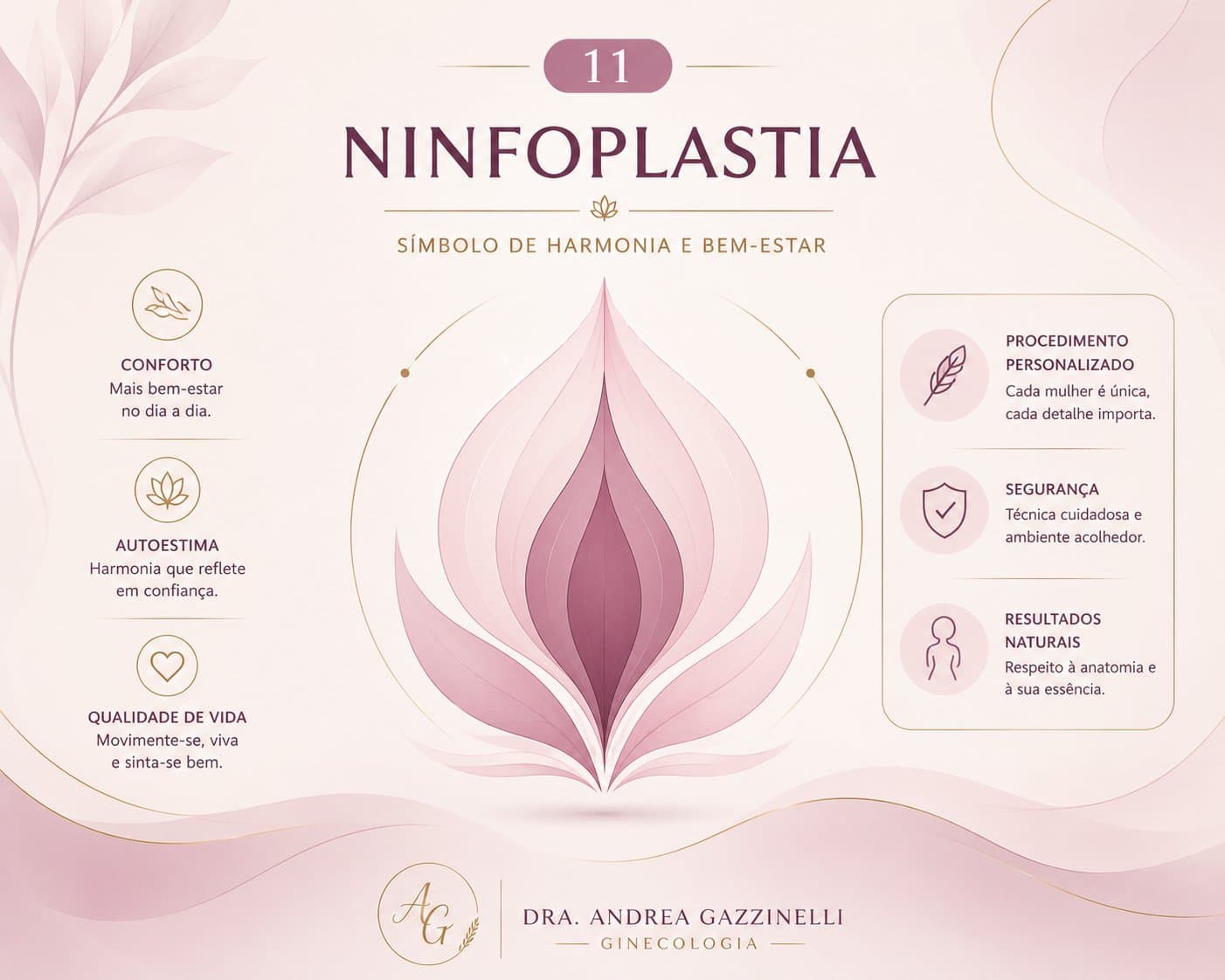 Ninfoplastia — ilustração médica esquemática
